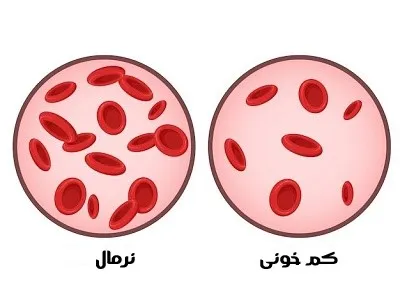 معرفی کپسول فروگلوبین